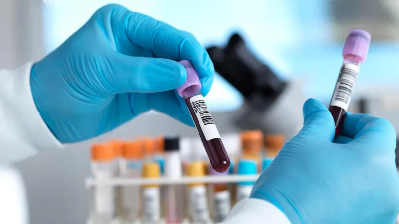 Ebola Scare Ends in Brazil as Both Suspected Patients Test Negative