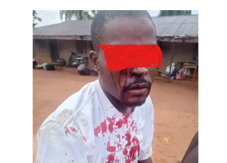 Ebonyi Police Detain Officers Over Alleged Brutalisation of Man, Launch Probe