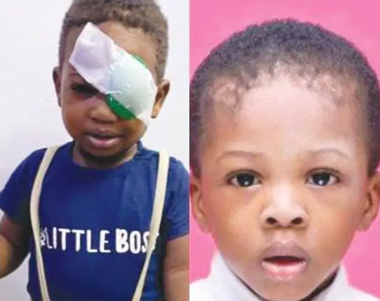 NDLEA Shooting: Three Years After 2-Year-Old Was Killed, Family Demands ₦200m Compensation, Medical Care for Brother